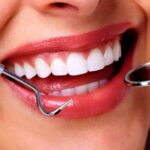 dental services