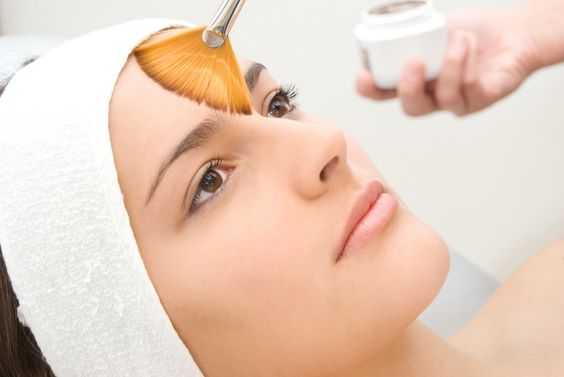 Types of Chemical Peel