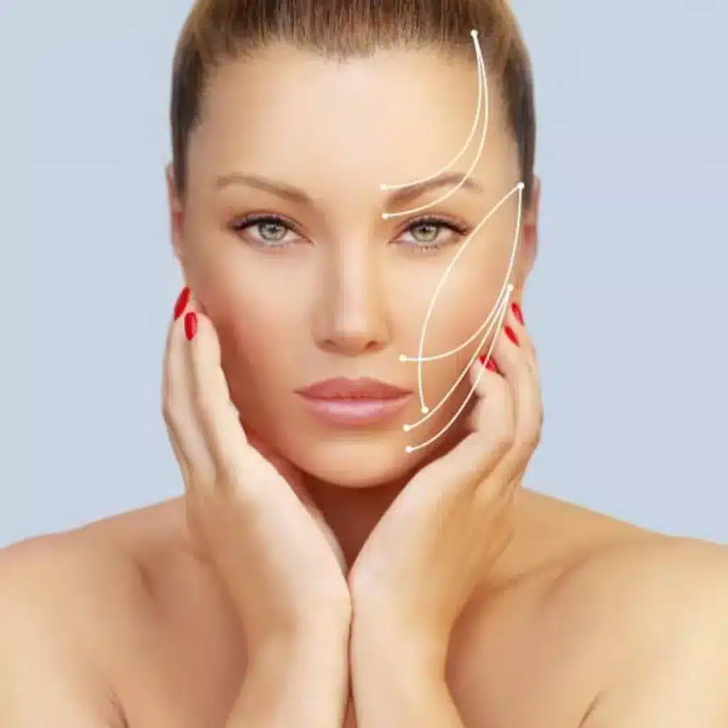 What To Expect During a Thread Face Lift Consultation