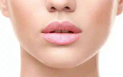 Natural results with our top-rated lip filler procedures