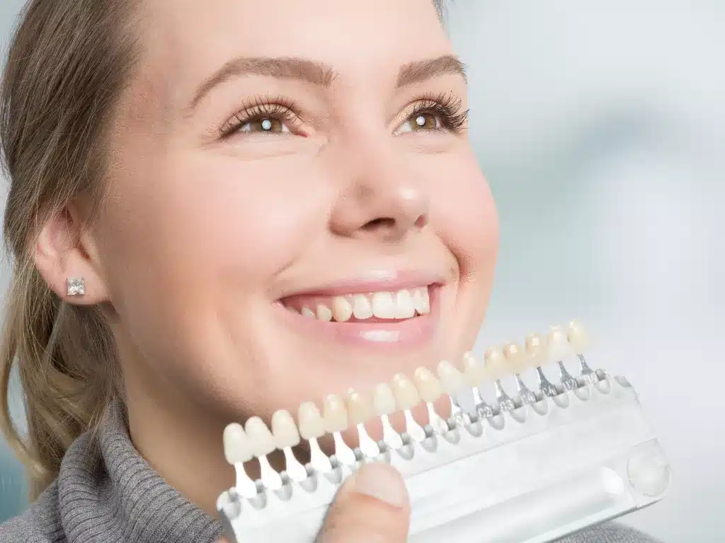 Palatal Veneers (Lingual Veneers): The Discreet Option