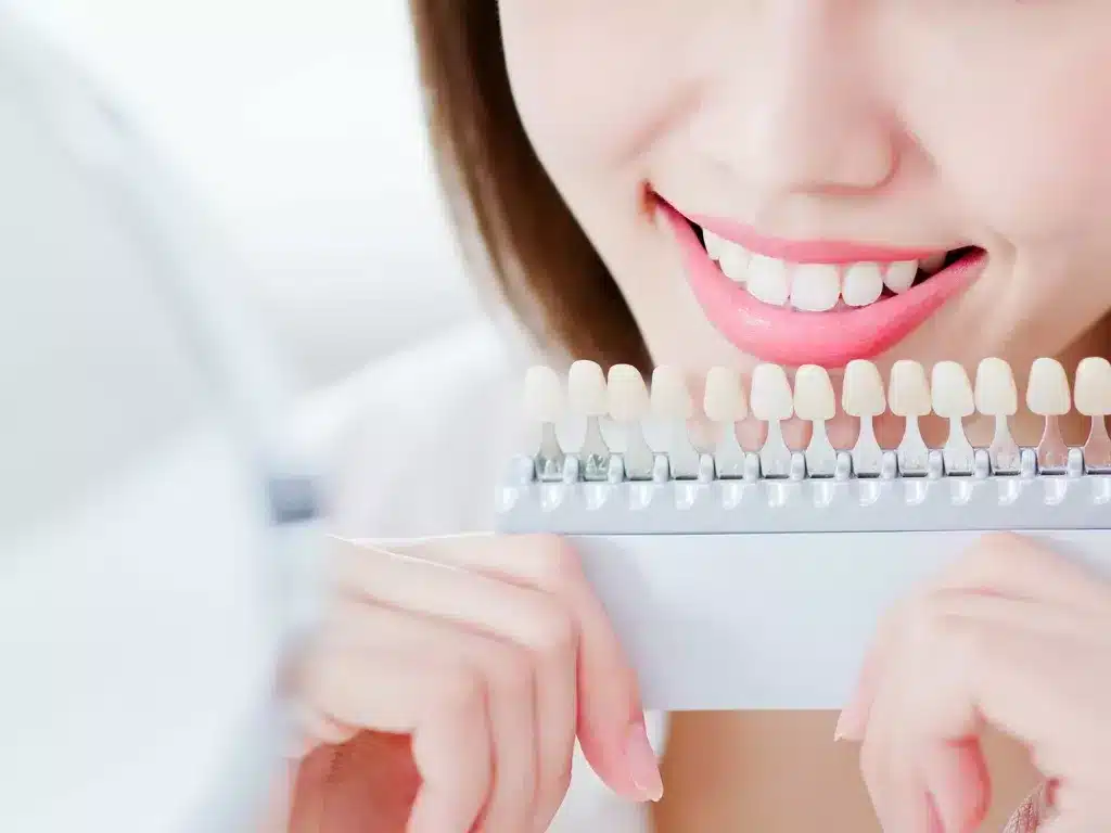 How to Choose the Right Veneers at Lavish Clinic Dubai?