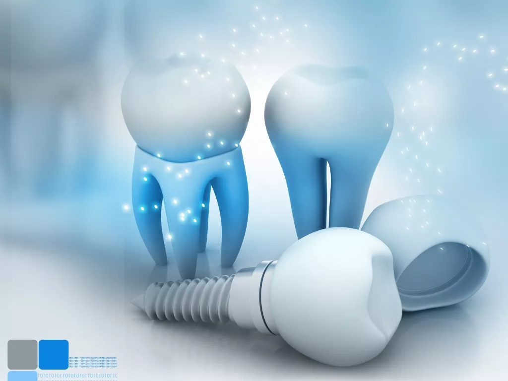 dental implants in dubai