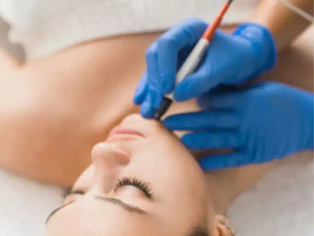 Dubai electrolysis treatment: Safe and effective hair removal for all skin tones.