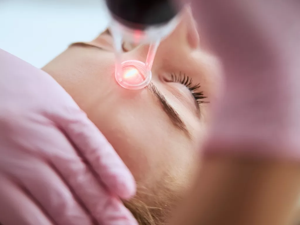 a woman haveing eyebrow laser session