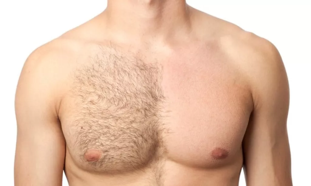 a man chest before and laser session